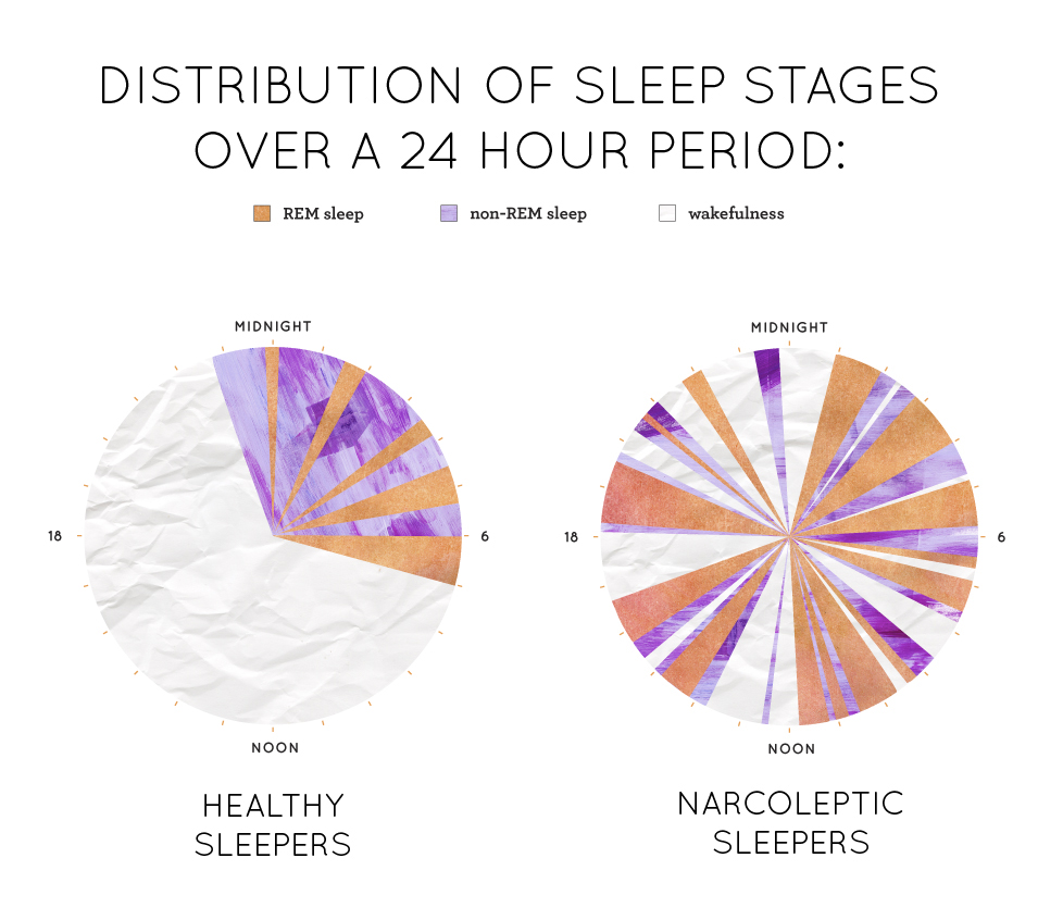 Narcoleptic vs normal sleep cycle over 24 hours